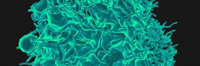 Immunotherapy at MSK