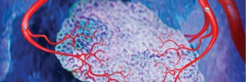 tumor in microenvironment